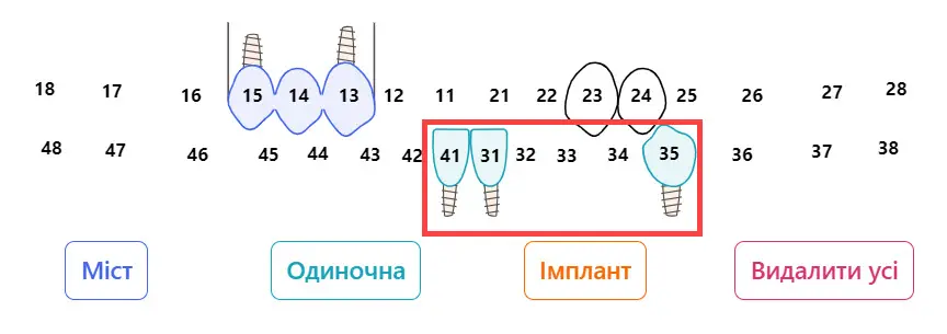 Додати імпланти