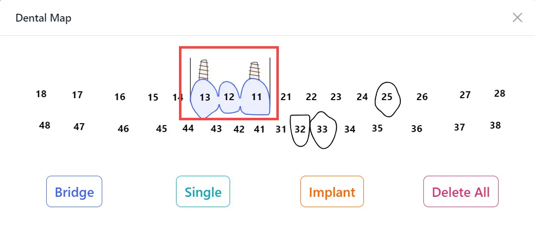 Define Implants