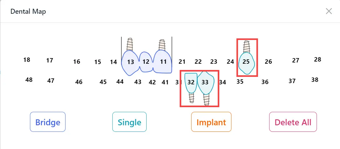 Define Implants