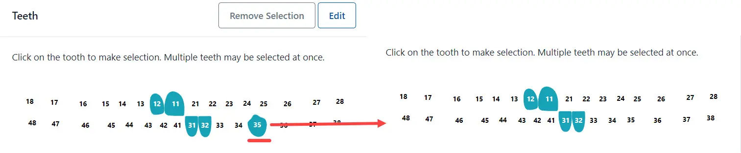 Remove selection from one tooth