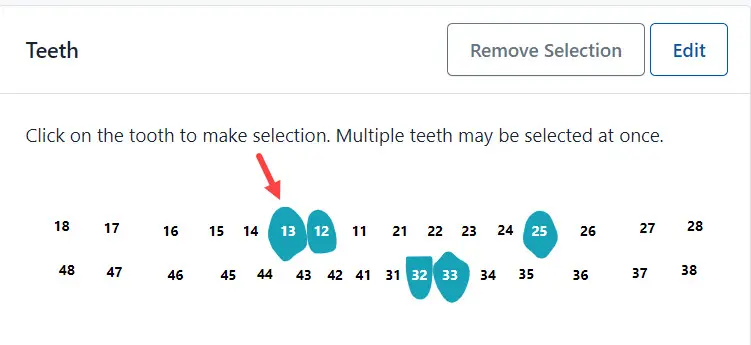 Selected Teeth